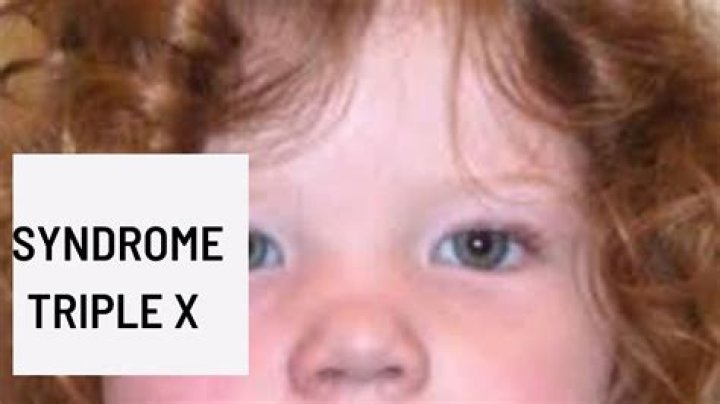 Discovering the Life of a Famous Person with Triple X Syndrome