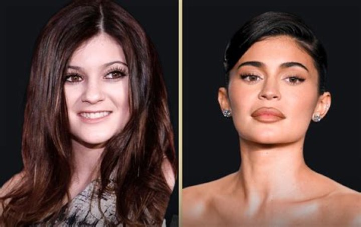 Kylie Jenner: A Journey of Transformation