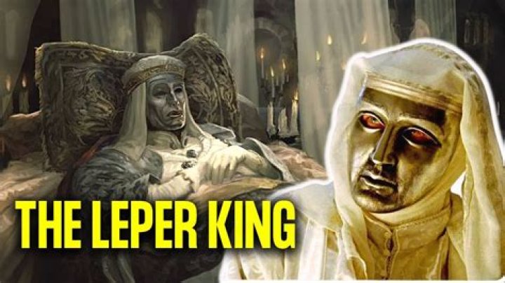 Uncover the Secrets of the Lepr King: A Comprehensive Guide