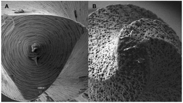 Unraveling the Mysteries of Kaitkrems of Leak