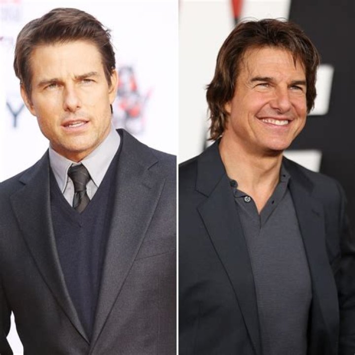 What Happened to Tom Cruise's Black Eye? Mysterious Injury Sparks Concern