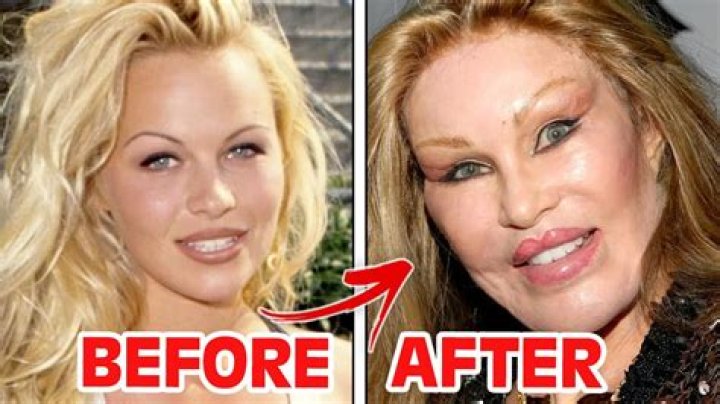 When Beauty Goes Wrong: The Shocking Stories of Celebrities Botched Inner Thigh Lipo